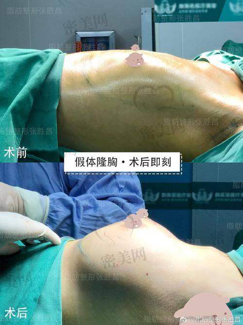 冯辉利医生口碑怎么样？