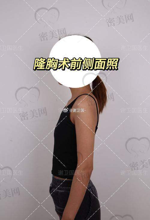 冯辉利医生擅长项目：