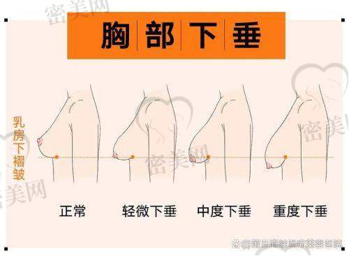 写在末尾：丰胸要走对路，别让20年前的梦变成今日的痛