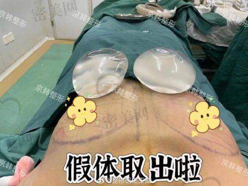 石家庄美联臣高玉伟隆胸：15800 元起的美丽魔法价
