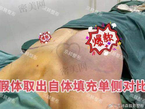 真人实例：见证 15800 元起的神奇蜕变
