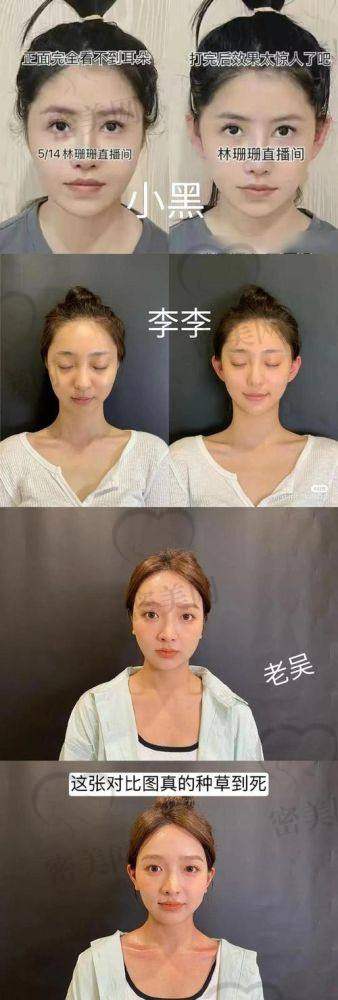 矫正手术：像一场奇妙的“魔法之旅”