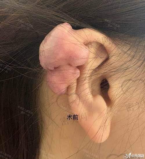 术后成效：惊艳到“原地起飞”