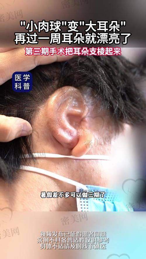 刘暾医生的技术特色和优势