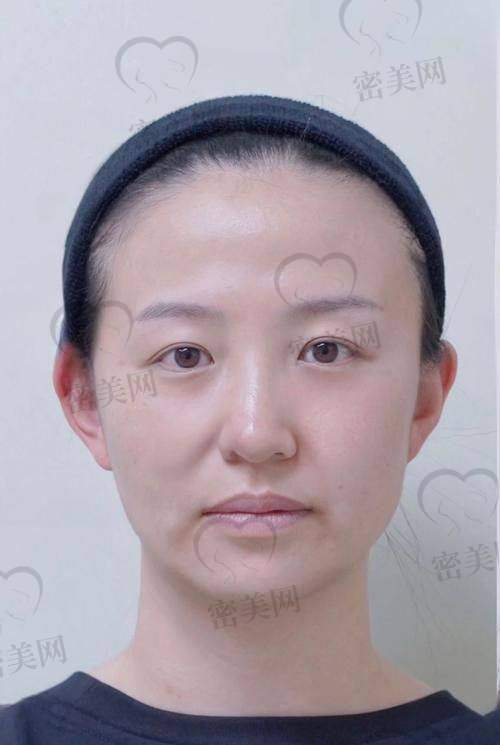 填充前后对比图的重要性
