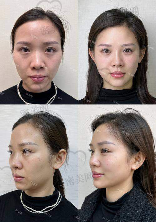 石家庄康蓓妍整形：专精靠谱的医美殿堂