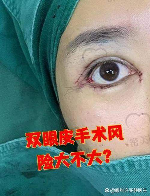 王衡健医生的技术优势：妙手回春的“神技”