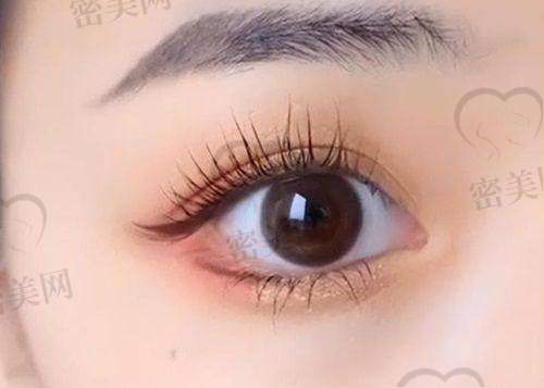 重庆米兰柏羽时光整形医院卢美均仿生美眼术：优势大揭秘