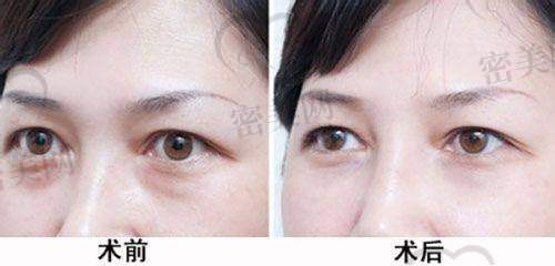 重庆米兰柏羽：星眸眼项目的实力后盾