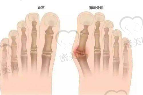 透明的价格体系｜主流项目参考价一览表