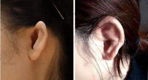 ：真实实用的选择