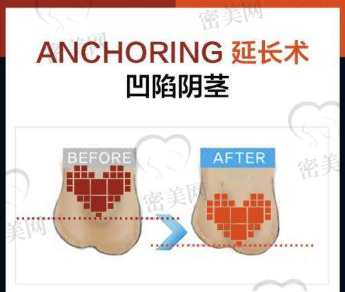 眼部整形項(xiàng)目
