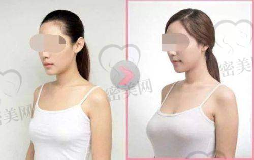医美机构活动信息大揭秘