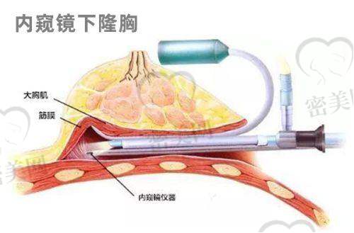 多项目情况