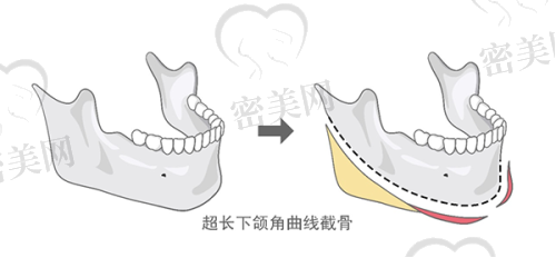 与其他医院对比
