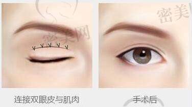 各项目详情