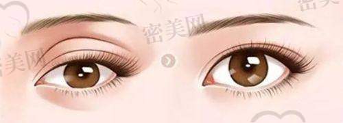 佛山华美联城私密整形项目表现如何?