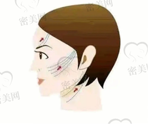 生长因子项目