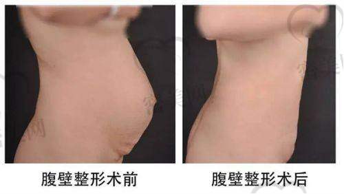 星悦医疗美容诊所：胶原美颜达人优选