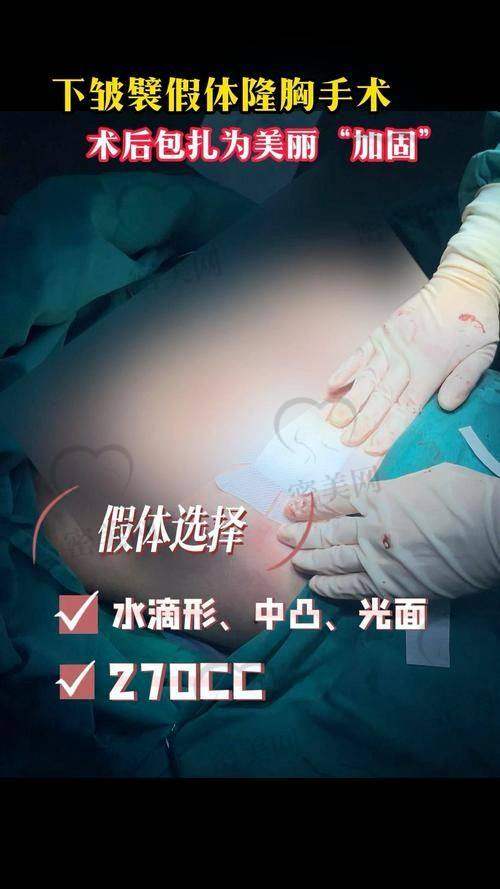 2025 - 2026 哈尔滨瑞丽整形价格表解析