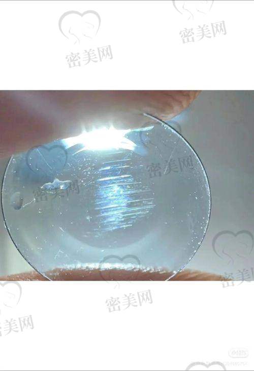 OK镜、RGP与离焦镜三者对比：性价比谁更胜一筹？