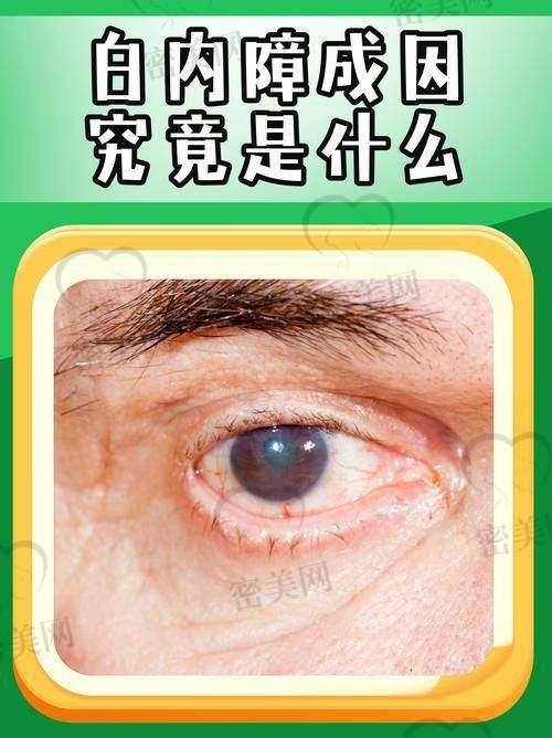 重庆白内障晶体价格影响因素有哪些？