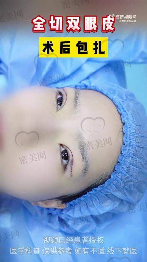 贾思源医生：专注眼综合和眼睑年轻化，审美在线
