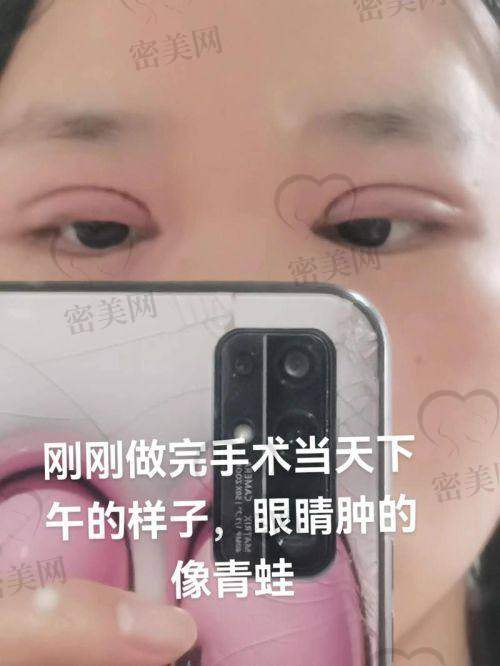沈阳艺星医疗美容：韩式眼技主推机构