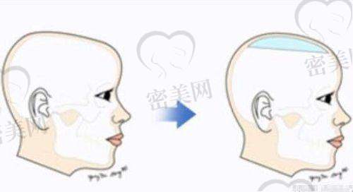 Face-Line菲斯莱茵整形外科——改脸型代表医院