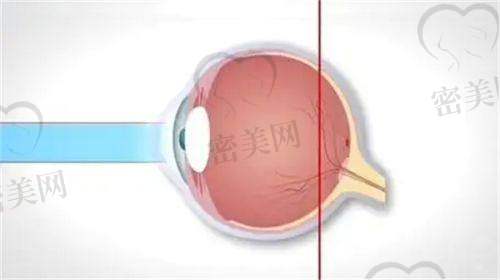 重庆西 南医院眼科:术后成效到底怎么样?