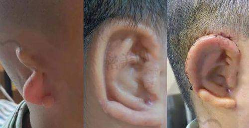 手术过程：像一场奇妙的魔法之旅