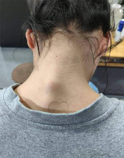 曹孟君医生团队坐阵:40年实力+技术传承,术后结果直接拉满