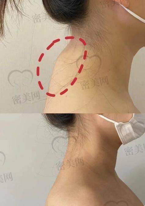 术后体验如何?服务流程细致、术后回访贴心又专精