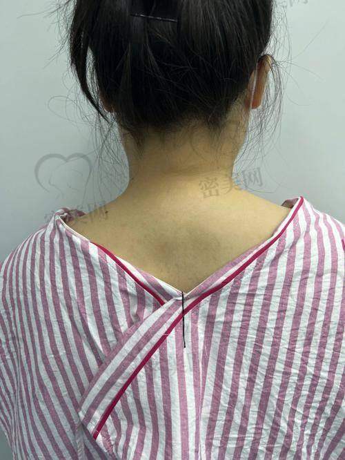 富贵包吸脂是核心技术?别说真的是太能打了