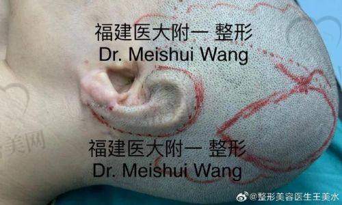 总结：张天宇医生，yyds！