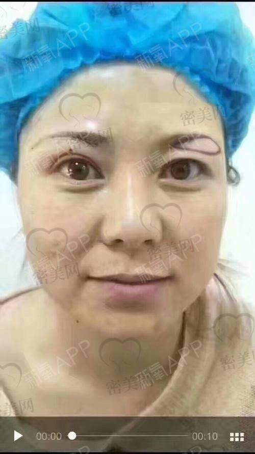 真人实例，美丽看得见！
