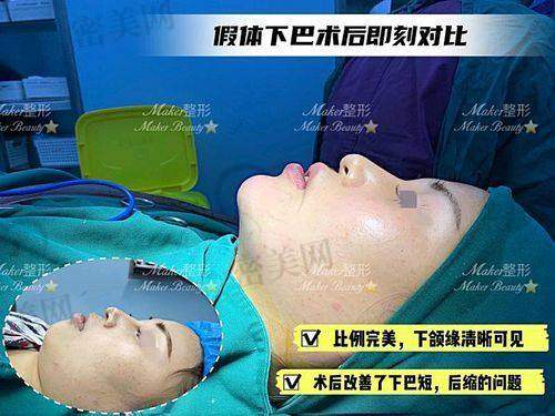 石家庄美联臣整形医院：专精整形机构，品质有保护！