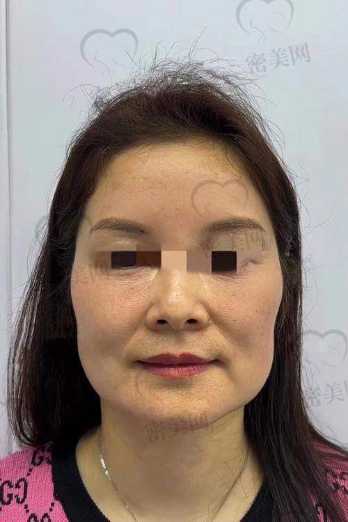 王洪医生修复技术的特色与优势