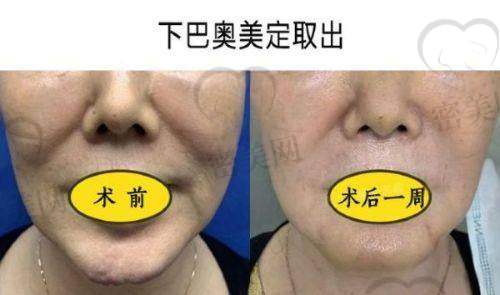 深圳曹孟君医疗美容