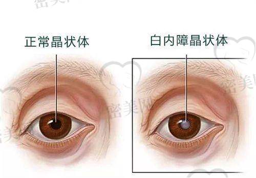 申请流程分几步？一图看清整个报销与手术路径