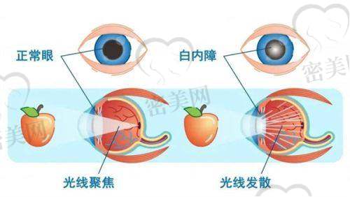 哪些群体优先安排？五类困难群体直接进“快速通道”