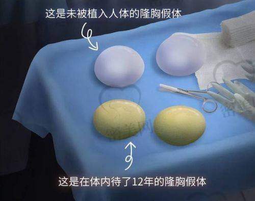 术后护理与修复