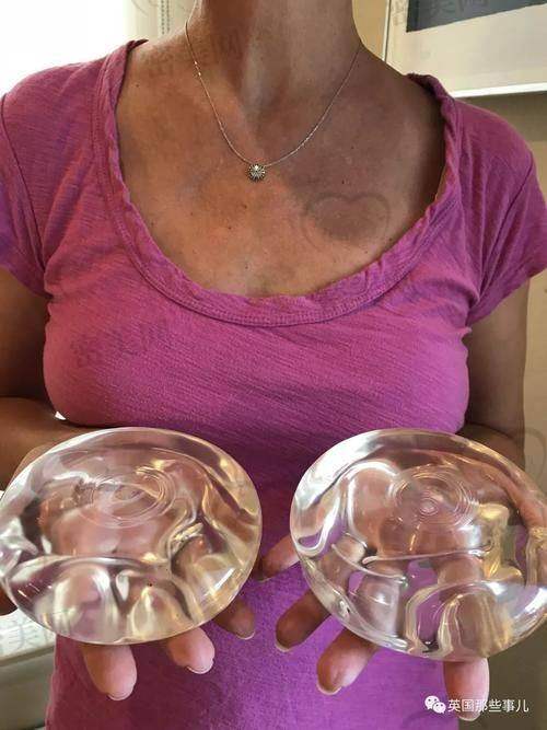 写在最后：傲诺拉适合哪些小姐姐选择？