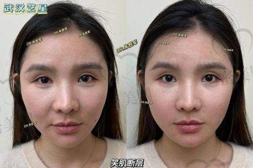 石家庄康蓓妍整形张继伟医生：美丽魔法师登场