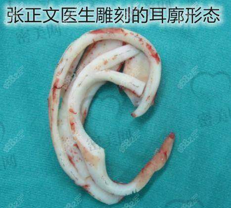 成都八大处热门耳整形医生推荐