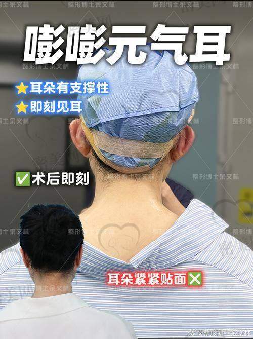 按术式复杂程度分：耳整形价格分层解析