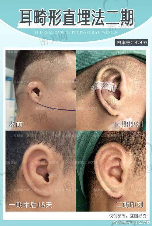 真实用户实例反馈：费用贵不贵，看体验