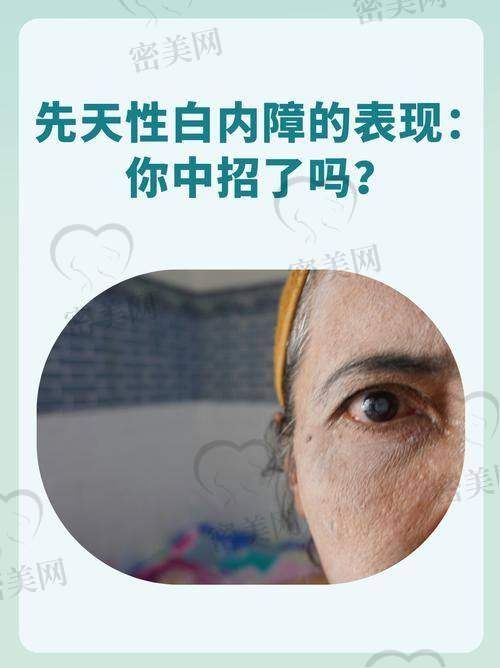 潍坊明润眼科医院为代表的定点机构有哪些优势？