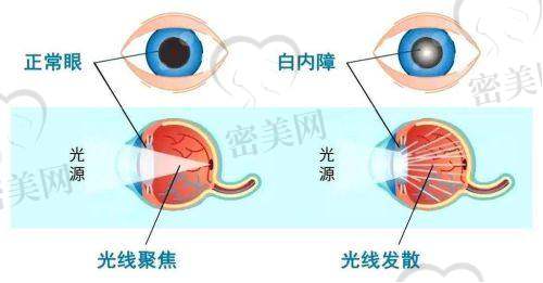 山东省眼科医院（济南）手术实力强，专家技术优