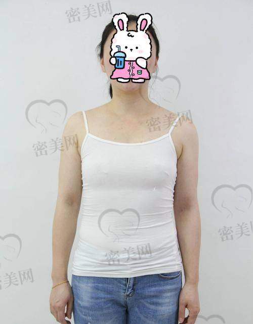 会不会是包膜挛缩？怎么分辨？